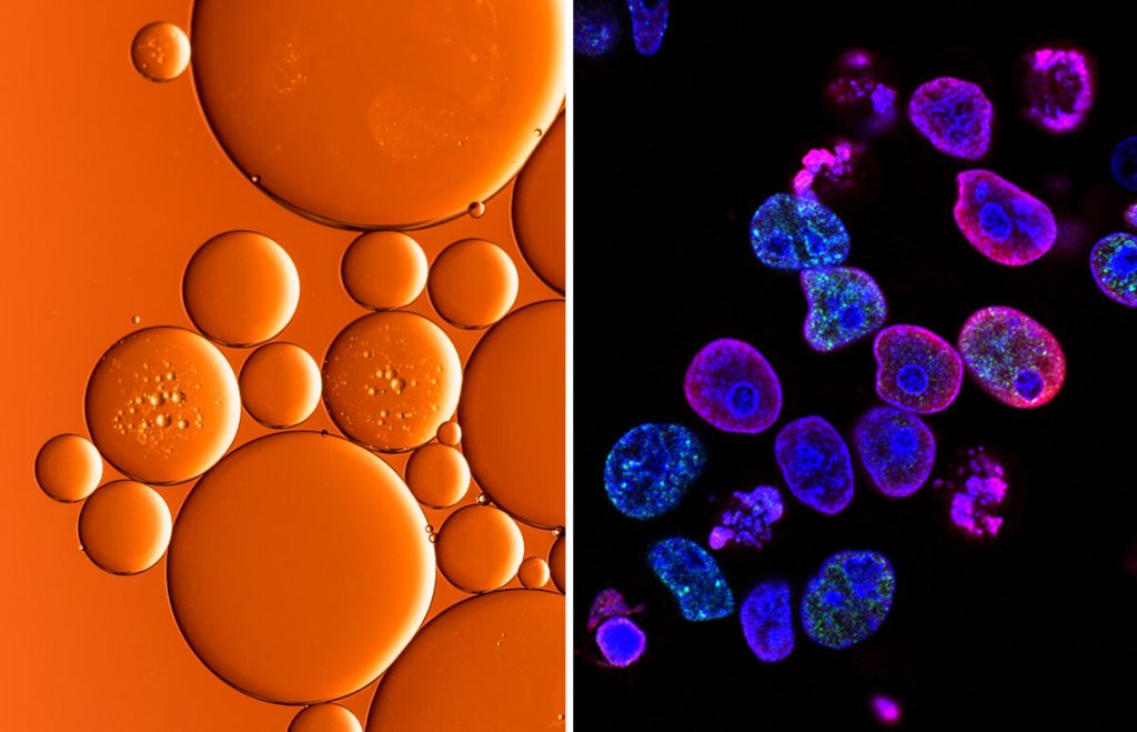 CBD olej a rakovinové bunky ako porovnanie