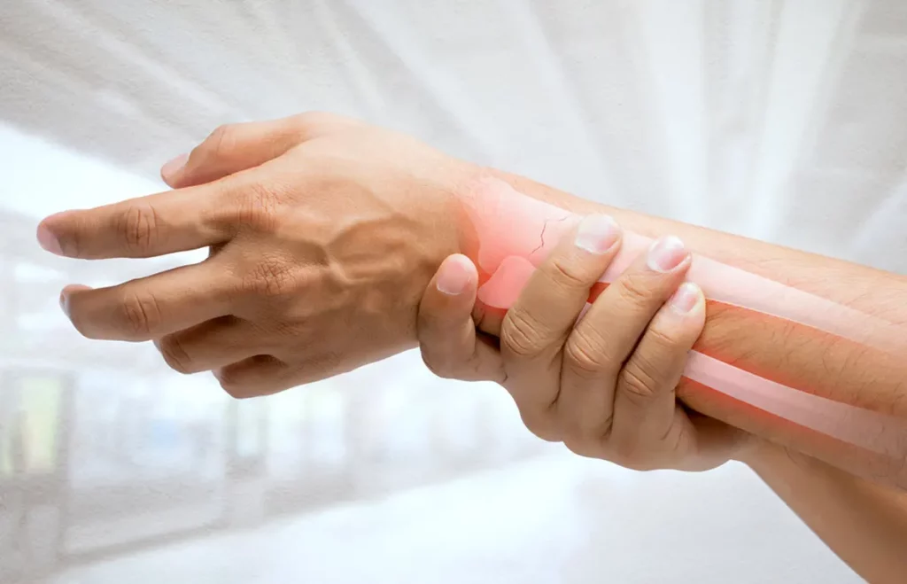 Osteoporóza - ilustračný obrázok: ruka s vizualizáciou boľavej kosti